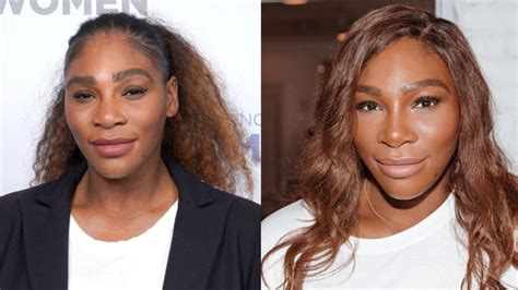 serena williams plastic surgery